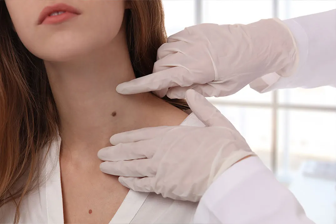 How S. Albertson can help with dermatologic procedures